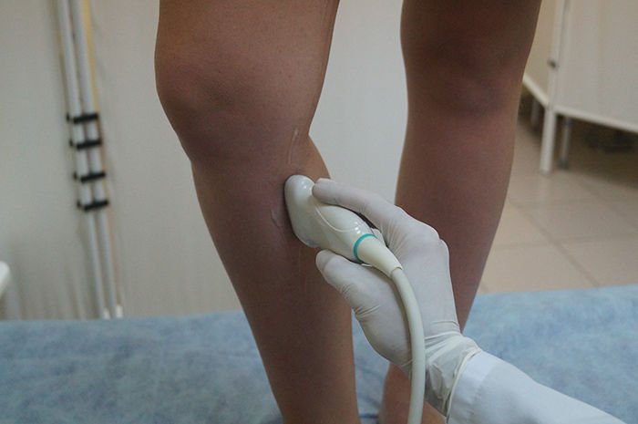 фото узи ног