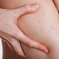 превью статьи