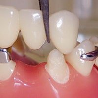 превью статьи